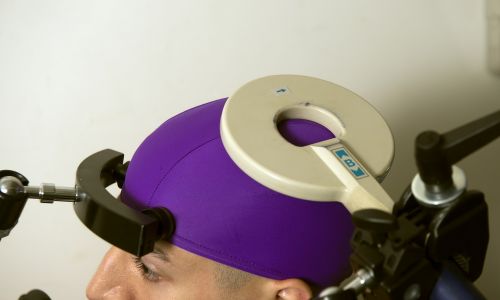 Odbiorca. Przezczaszkową cewkę do stymulacji magnetycznej umieszcza się nad częścią mózgu, która kontroluje ruchy prawej ręki odbiorcy. Fot. Mary Levin, University of Washington