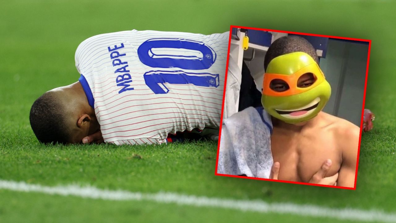 Kylian Mbappe doznał kontuzji podczas meczu z Austrią (fot. Getty)