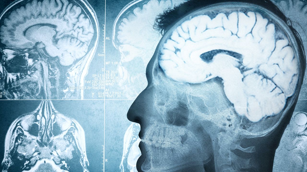 Każdy ludzki mózg dzięki neuronalnym połączeniom ma unikalną budowę i aktywność (fot. Shutterstock) Każdy ludzki mózg dzięki neuronalnym połączeniom ma unikalną budowę i aktywność (fot. Shutterstock)