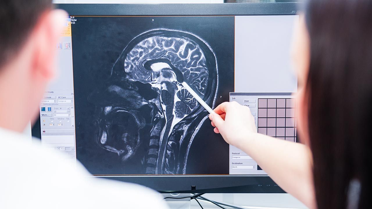 Ludzka zdolność do „powstrzymania się od natychmiastowej nagrody” ma podłoże w działaniu mózgu (fot. Shutterstock/Okrasiuk) Ludzka zdolność do „powstrzymania się od natychmiastowej nagrody” ma podłoże w działaniu mózgu (fot. Shutterstock/Okrasiuk)