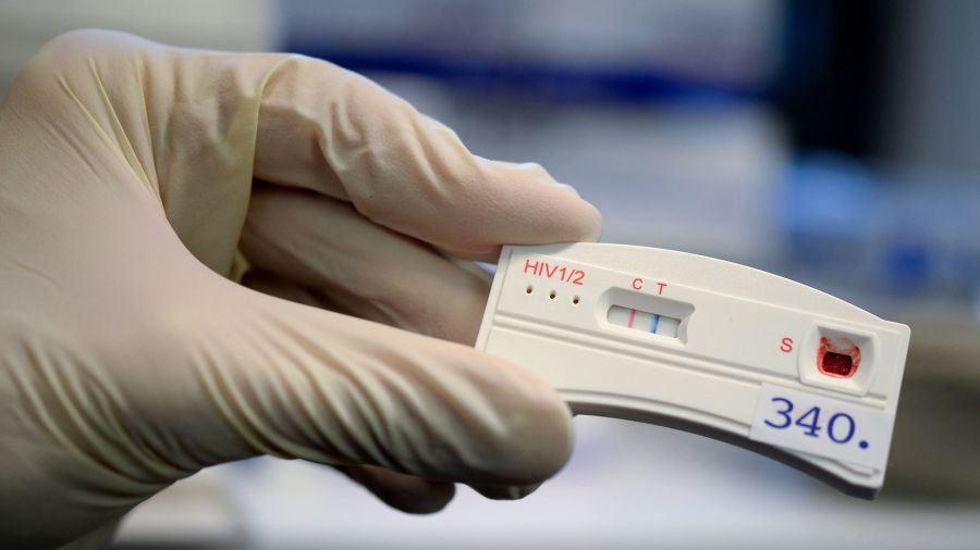 Bezpłatny test na HIV w poradniach podstawowej opieki zdrowotnej