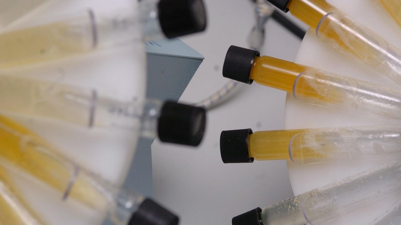 WADA bada próbki olimpijczyków, by zapobiec oszustwom